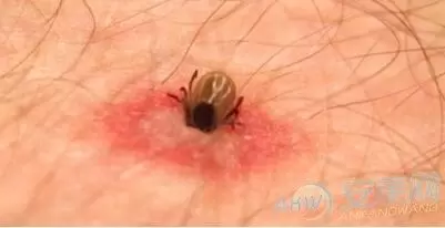 做梦梦见虫子钻进皮肤,梦见虫子钻进皮肤我又拽出来了插图