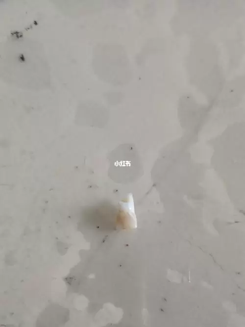 下牙掉了代表什么亲人 梦见掉牙家里有丧事插图