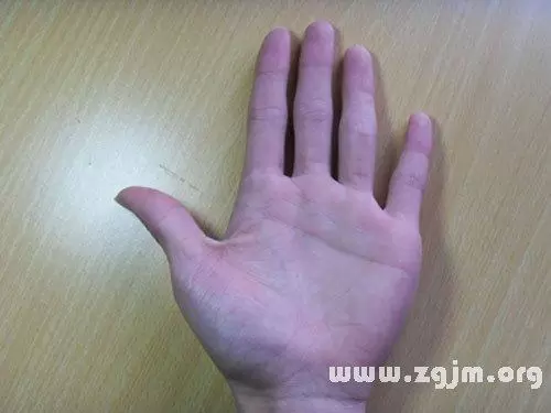 梦见老公手断吉凶 梦见老公指头断了代表什么插图