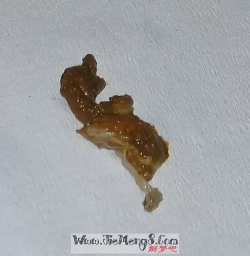 做梦屁股上有大便 做梦大便失禁怎么回事插图