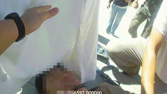 危急之下，民警用手抵住了患病男子紧咬的牙齿插图2